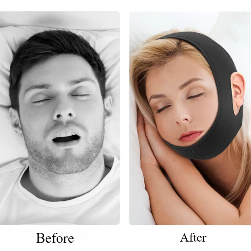 Anti Snore Belt Stop Snoring Chin Strap Woman Man Night Sleeping Support Aid Tools Snoring Protection Jaw Bandage Health Care